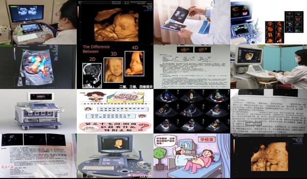 汕头四维彩超是不是b超检查 - 汕头四维彩超是不是b超