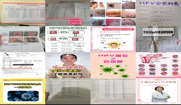 宫颈hpv53型好不好 - 汕头宫颈hpv53型阳性是什么意思