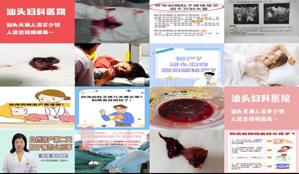 流产手术会痛吗? - 汕头流产了会疼吗