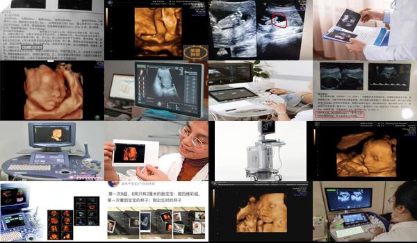 四维彩超和b 超的设备一样吗 - 汕头四维彩超和系统b超