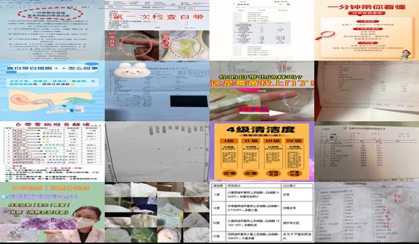 汕头哪里检查妇科比较好 - 汕头白带检查什么时候最好