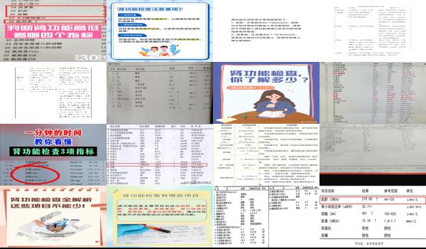 汕头肾功能四项检查什么时候做 - 汕头肾功能四项检查什么