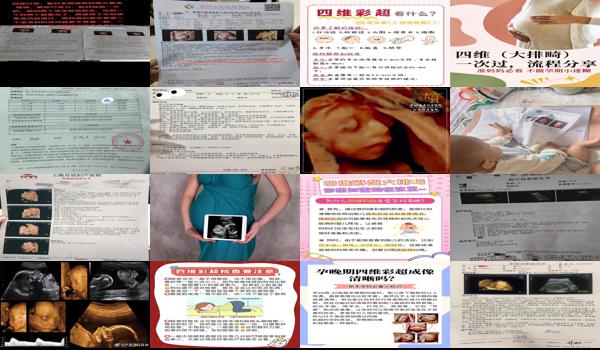 汕头四维多少钱 - 汕头做四维有什么好处