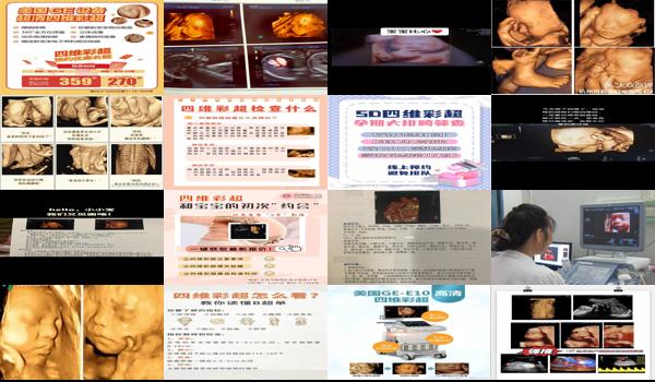 汕头四维彩超可以排畸吗多少钱 - 汕头四维彩超可以排畸吗