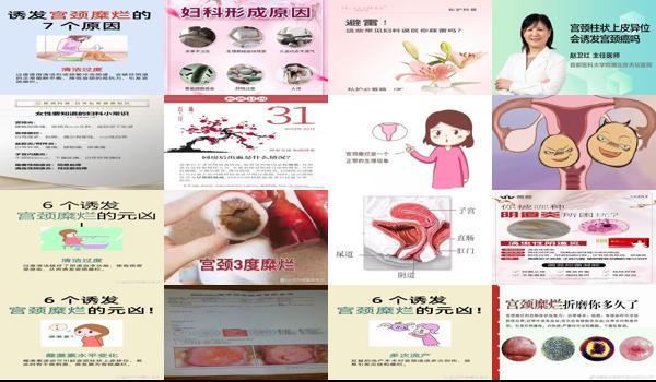 同房频繁会引起宫颈糜烂 - 汕头房事频繁容易诱发宫颈糜烂吗