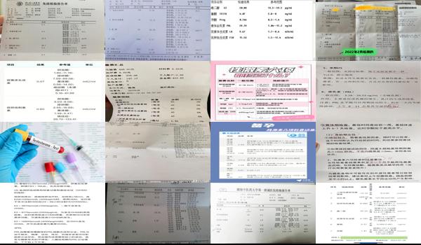 汕头性激素检查什么时候做 - 汕头性激素检查什么