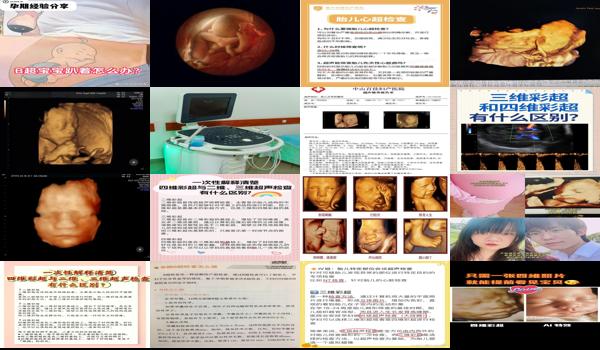 汕头四维多少钱 - 汕头孕期查三维和四维有什么区别