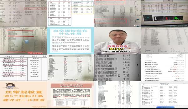 汕头血常规多久检查一次比较好 - 汕头血常规多久检查一次