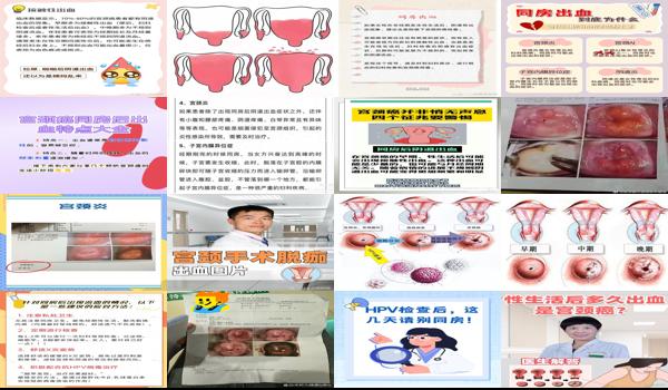 行房宫颈出血怎么回事和月经颜色一样 - 汕头行房宫颈出血怎么回事